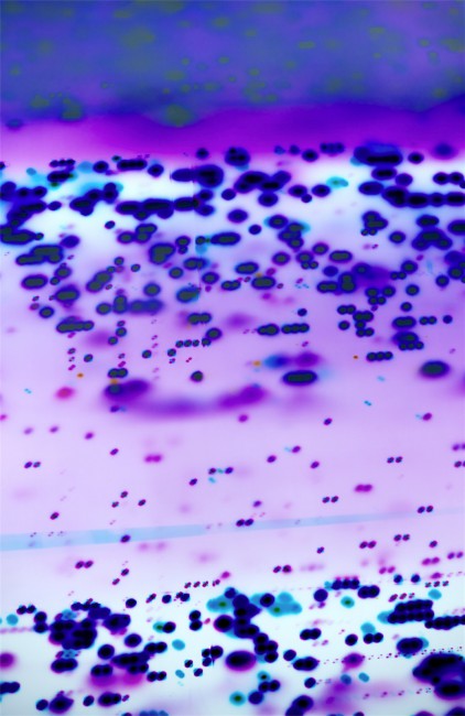 Photonuclear1